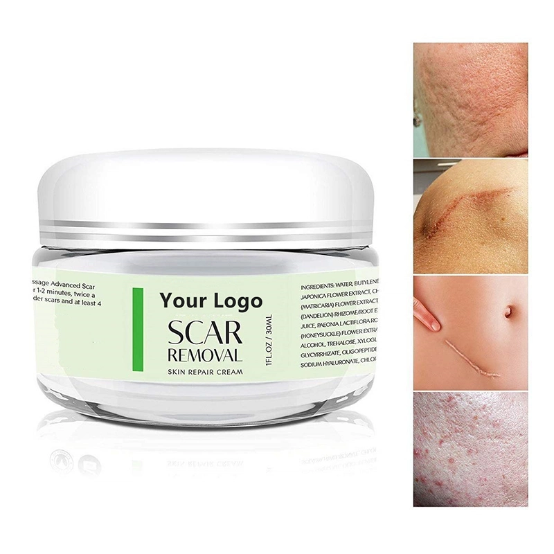 Cicatrices Remover anciennes et nouvelles cicatrices Natural Organic silicone grossesse Crème de réparation de cicatrice gel de cicatrice