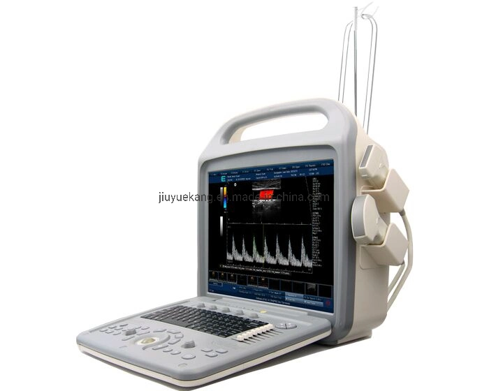 Medical Equipment, Portable 16 Channel Digital Ultrasound Scanner