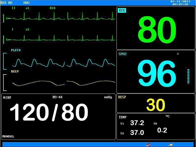 6 párr el ECG, SpO2, el PNI, Temperatura, Resp, CO2 de varios parámetros Pdj 3000 Monitor de paciente