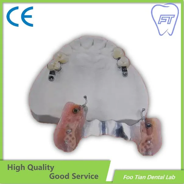 Hybrid Implant Denture Supplies Dental Custom Titanium Abutments Used for Implant Cases