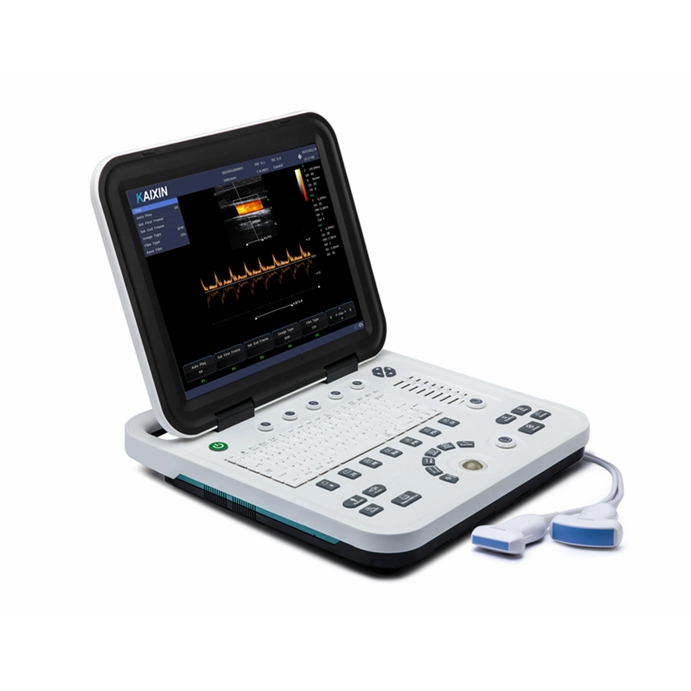 Portable Medical Ultrasound Instruments Ecography Echo Doppler Ultrasound 2D Gynecologic / Pregnancy Ultrasounds Machine