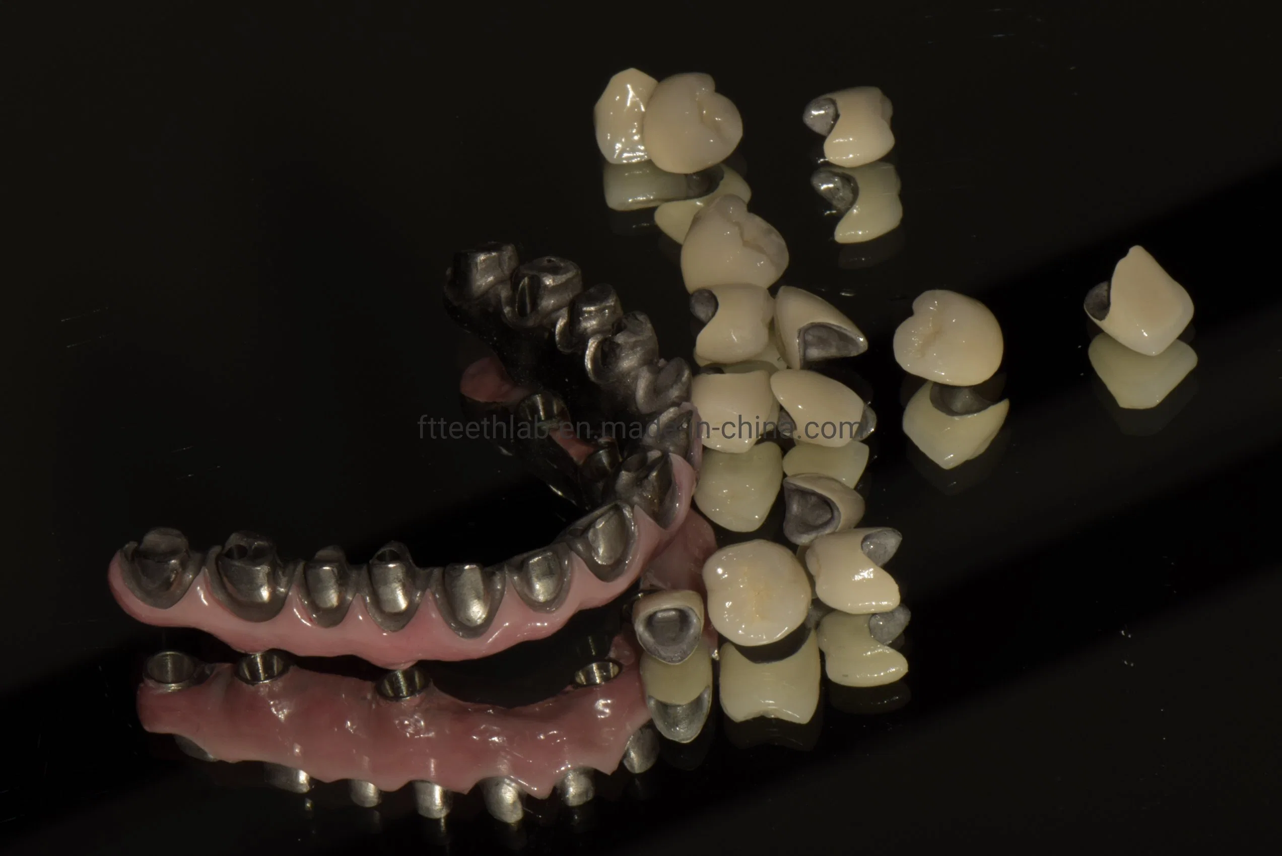 Full Arch Zirconia Screwed Implant Bridge