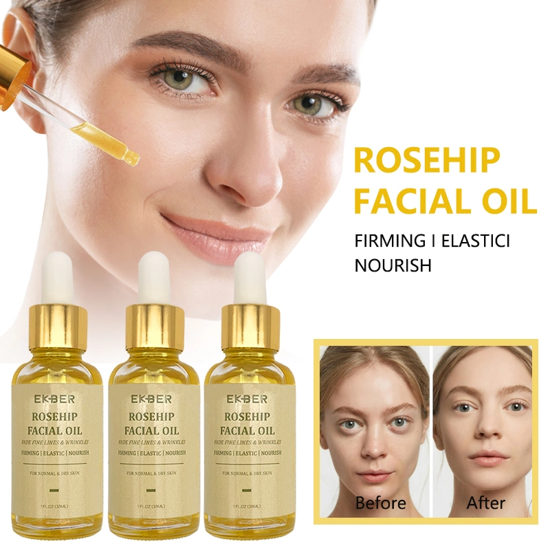 Baixo MOQ Private Label orgânico Rosa Moschata óleo de semente Óleo essencial anti Acne Rosehip brilhante