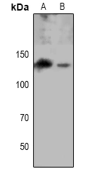 Epha8 (Phospho Y615) Polyclonal Antibody