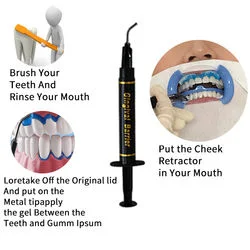 Zahnblanchiment Zahn Blau gingival Gum Barriere Schutzgel für Zahnaufhellung