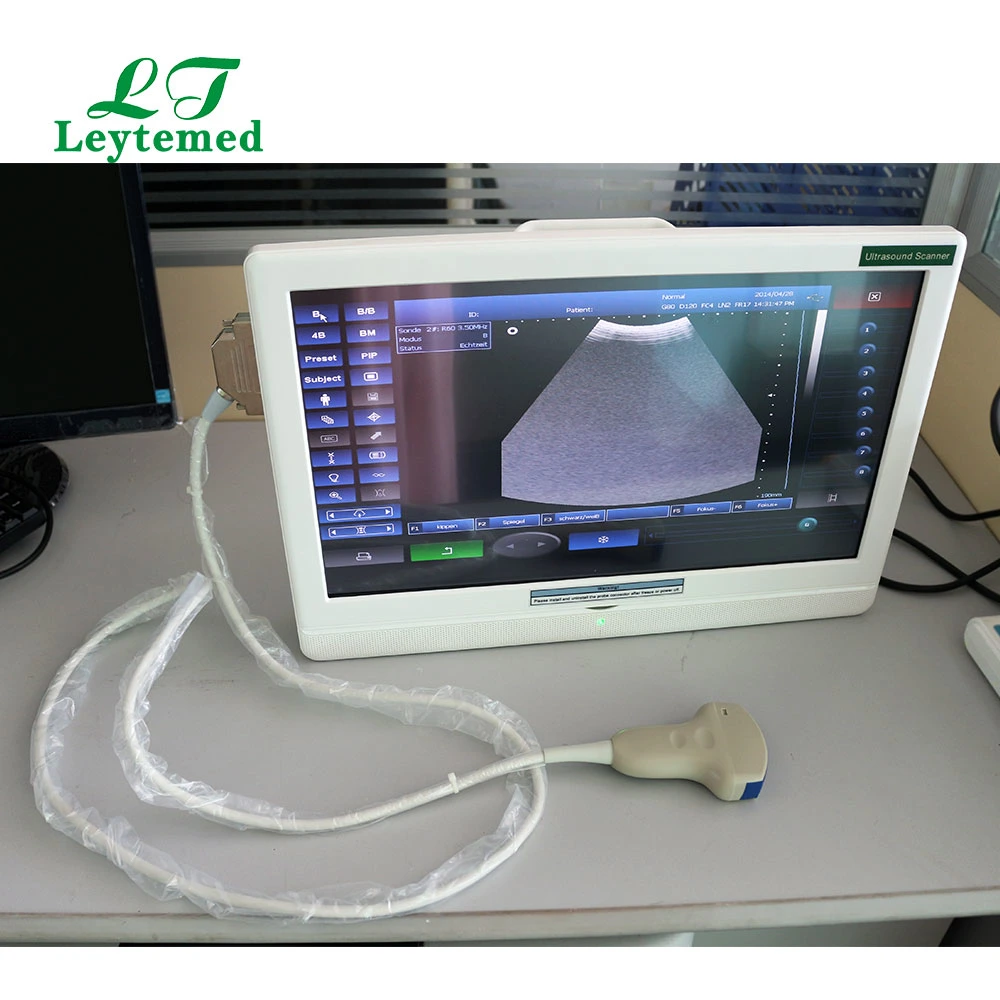 Ltub21V Portable Vet Touch Screen LCD Ultrasound Scanner for Pet Hospital