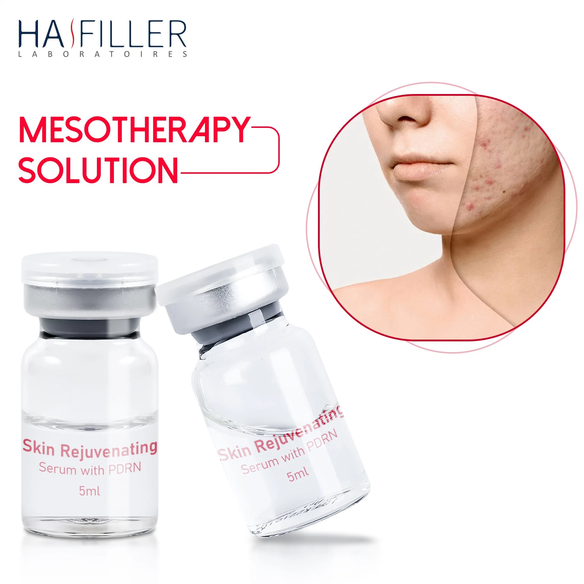 High quality/High cost performance Repair Skin Sun Damage Skin Rejuvenating Serum Pdrn Injection Mesotherapy Serum