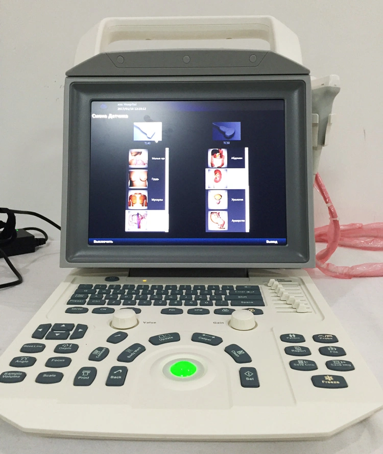 My-A026 All Digital Color Doppler Ultrasonic Diagnostic System 12.1 Inch Portable Doppler Ultrasound Machine