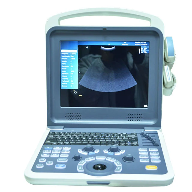 Ultrasound Machine Doppler Color 3D Original Factory