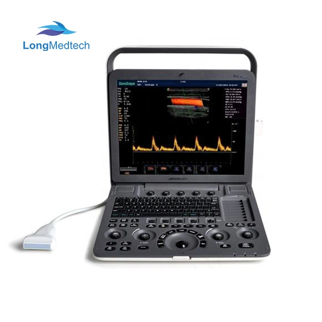 Professional 4D Color Doppler Sonoscape Ultrasound Scanner/Portable Sonoscape S8 Exp