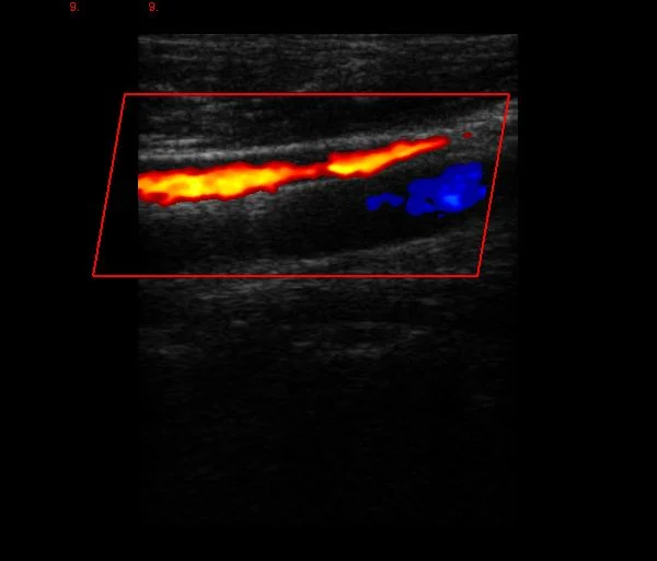 2023 High quality/High cost performance 15 Inch Trolley LCD Color Doppler Ultrasound Scanner