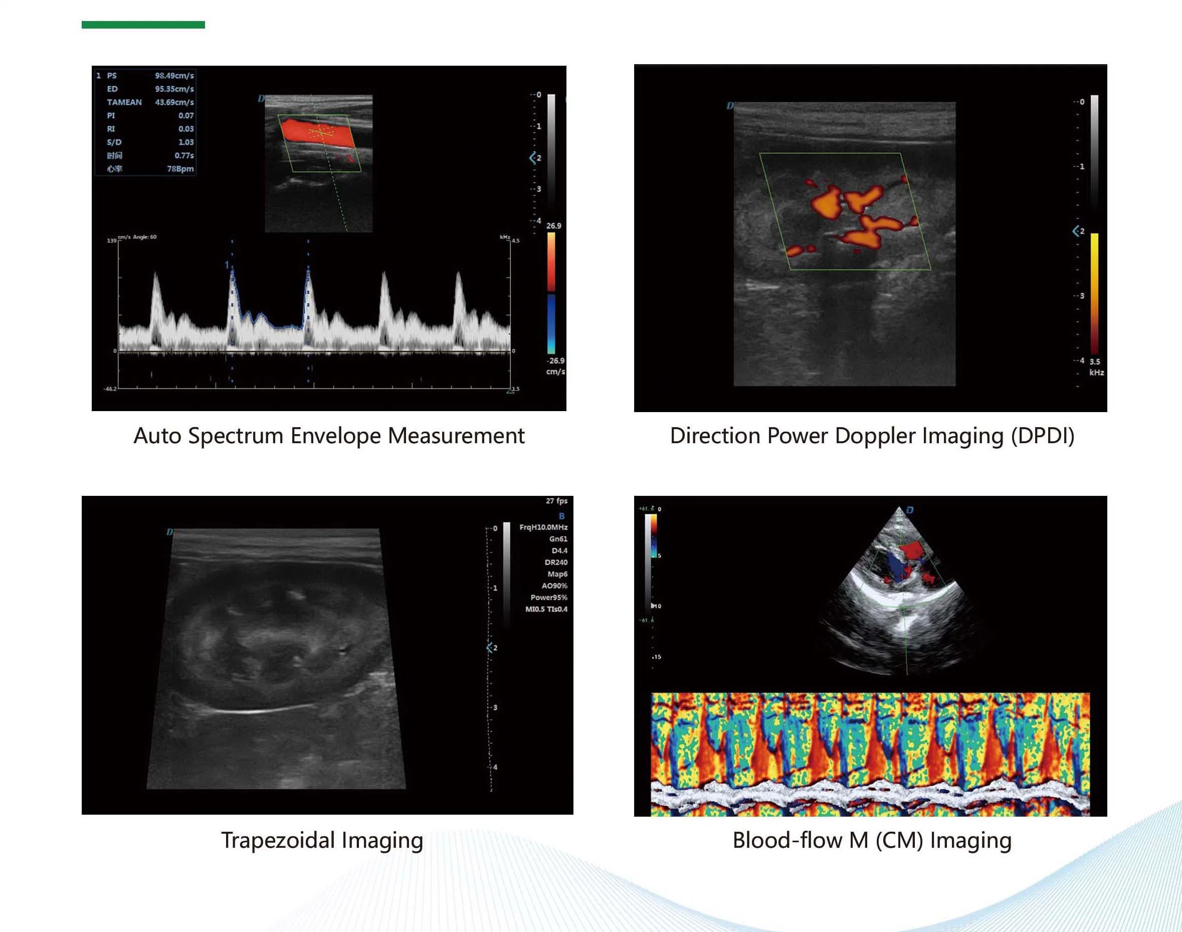 Medical monitor HD de 21,5 pulgadas (23,8 pulgadas opcional) El ultrasonido veterinario