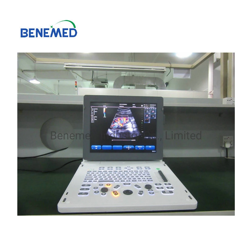 2D Echo Color Doppler Ultrasound Scanner Diagnostic Equipment