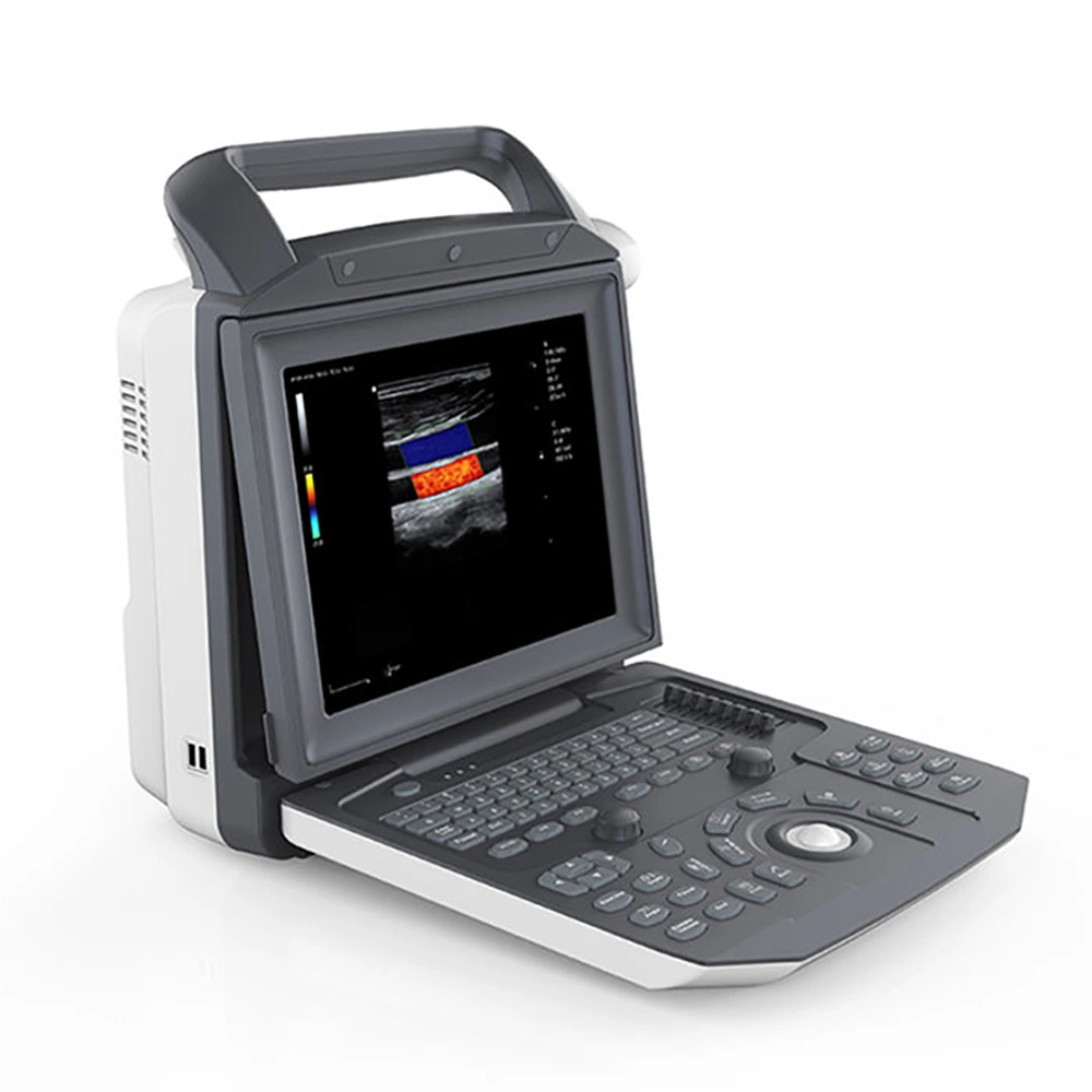 Портативный медицинский портативный компьютер 3D 4D Ultrasonic Ecografo Color Doppler Cardiac Ультразвуковая система