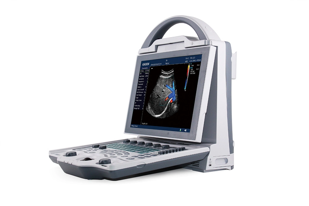 Factory Direct Supplier Digital Color Portable Vet Doppler Veterinary Ultrasound Scanner