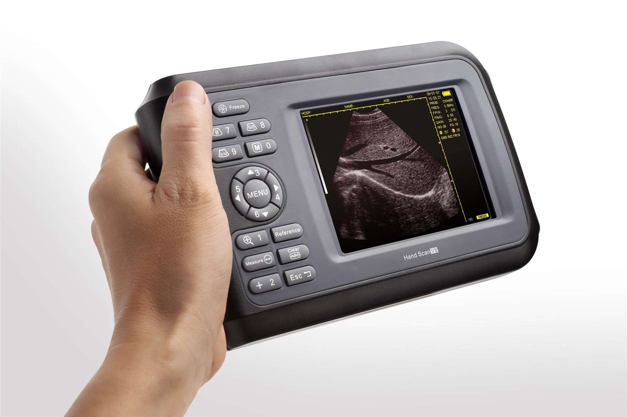 Rsd-V8 Handheld Vet Portable Digital 5 Inches Ultrasound Machine Veterinary Ultrasound