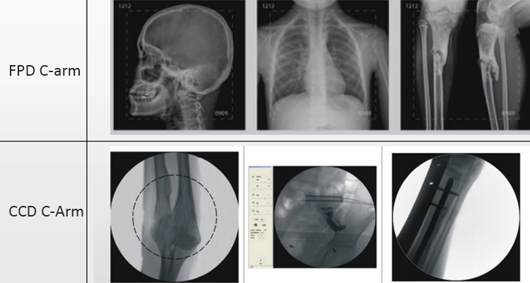 Portable 5kw Digital C Arm X Ray Machine