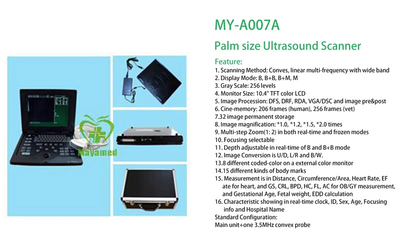 Escáner portátil de ultrasonidos de tamaño Palm My-A007A escáner de ultrasonidos de ordenador portátil