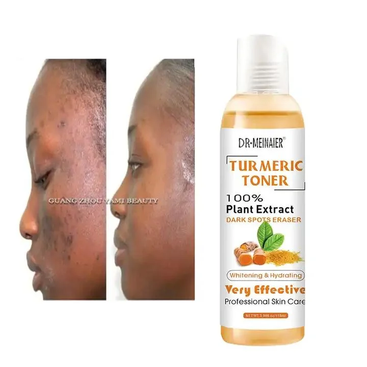 Free Sample Tumeric Dark Spots Face Toner Spots Eraser Corrector Turmeric Fades Blemishes Dark Spots Remover Acne Toner