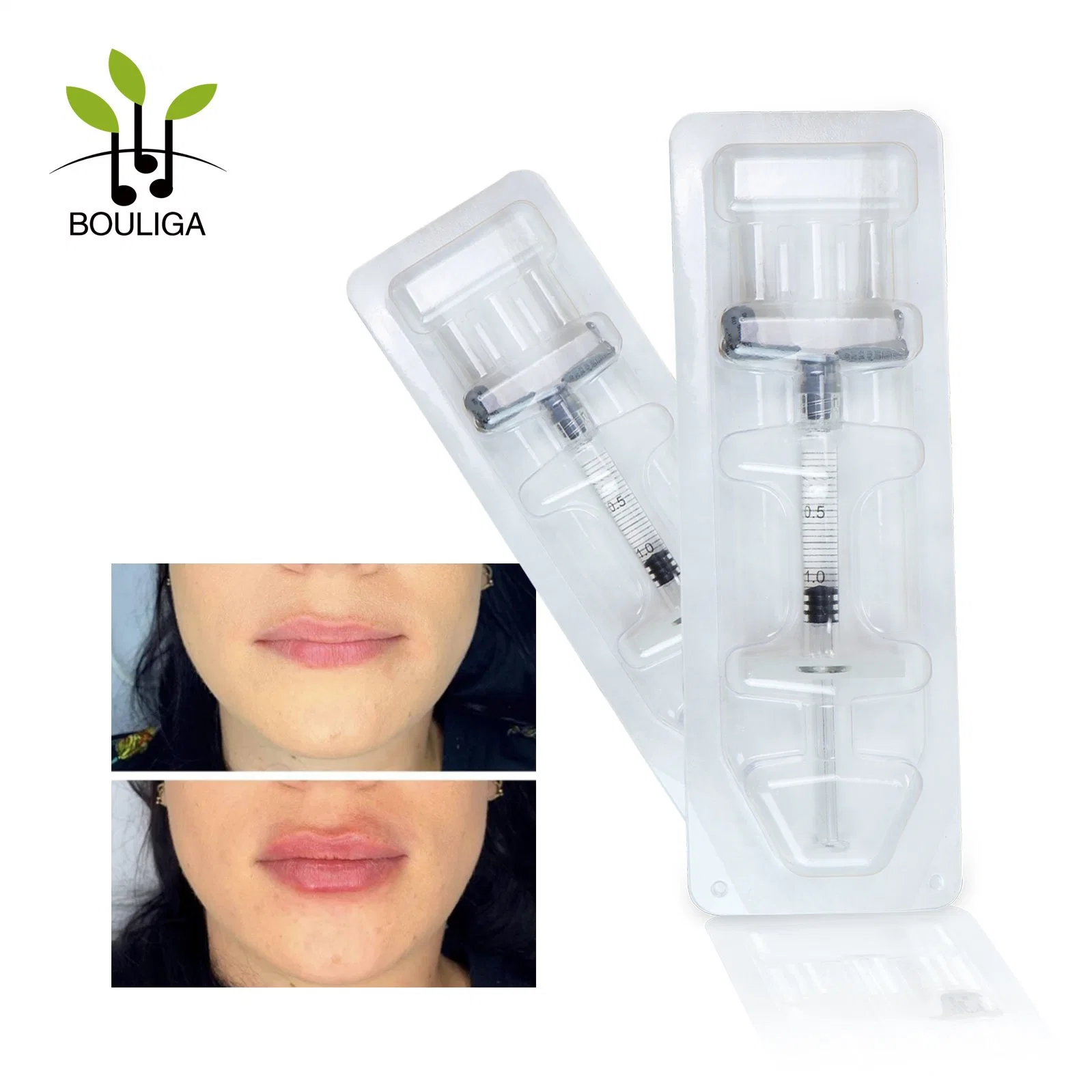 Korea Fine Derm Deep 2ml Hyaluronsäure Kaufen Injektionsbares Dermal Füllstoffe Injektionsgeleinspritzung Lip Filler