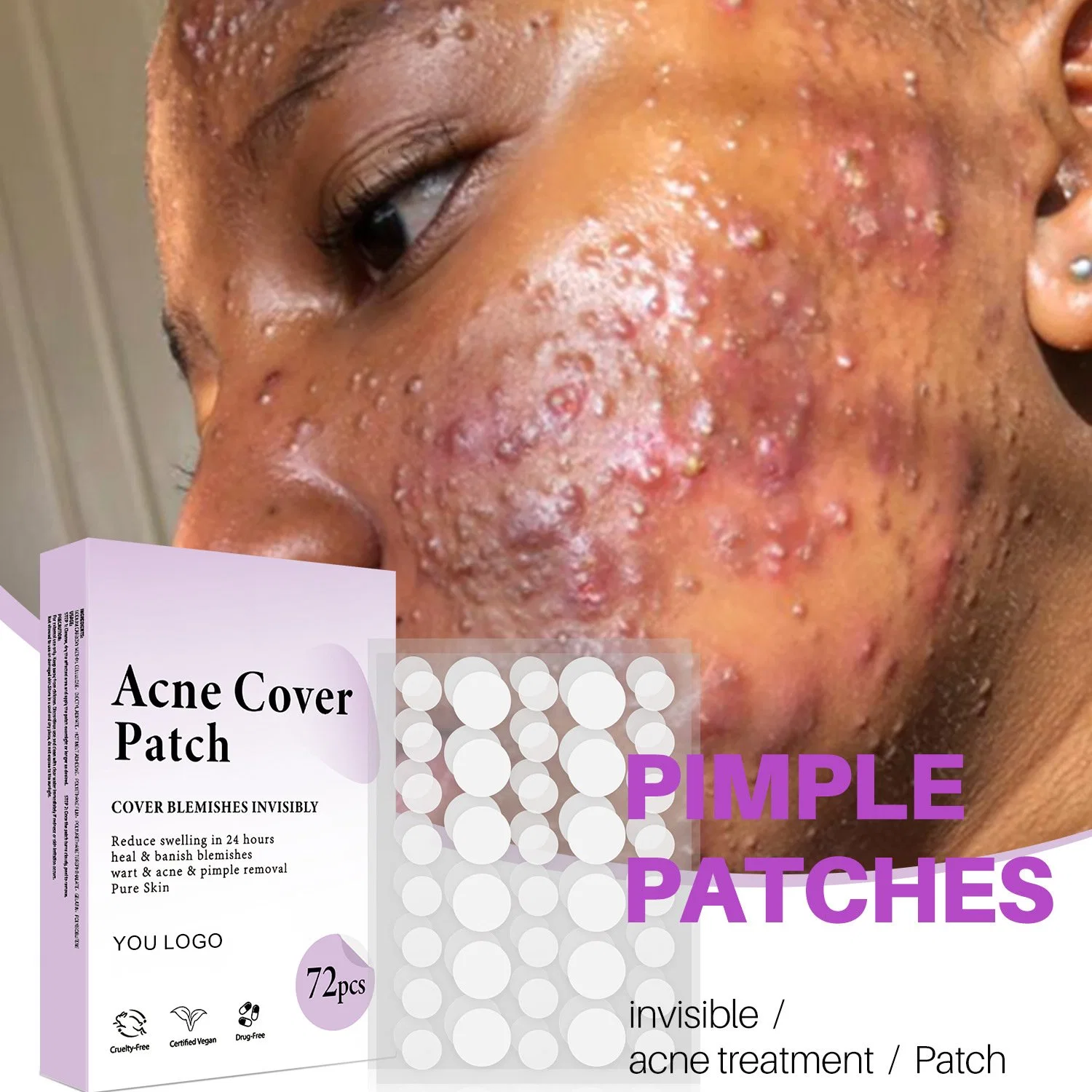 Beauty Cosmetics Skin Care Pimple Patch Blemishes Breakouts Spot Treatment Facial Stickers