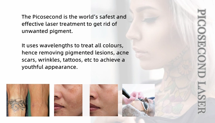 Pico Laser Beauty Salon Equipo Tatuo Pigments Tatuo Removal Laser Máquina láser de picosegundos de cuidado de piel con peeling de carbono