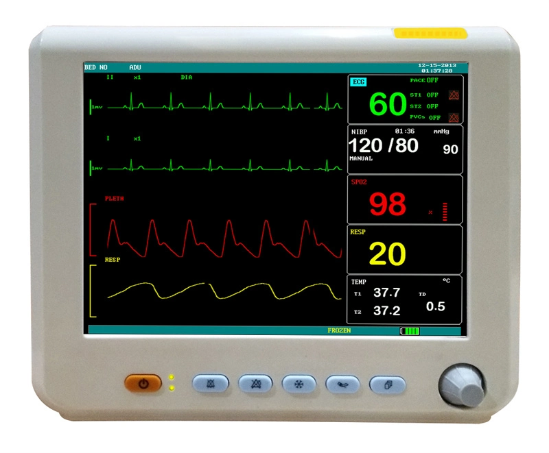 China ECG, SpO2, PR, PNI, Temp, Resp Hospital Medical UCI pequeño quirúrgico Monitor de paciente de 8 pulgadas