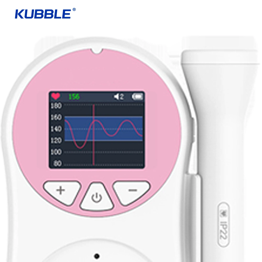 Radiation Baby Doppler Fetaler Ultraschall Doppler Fetaler Detektor