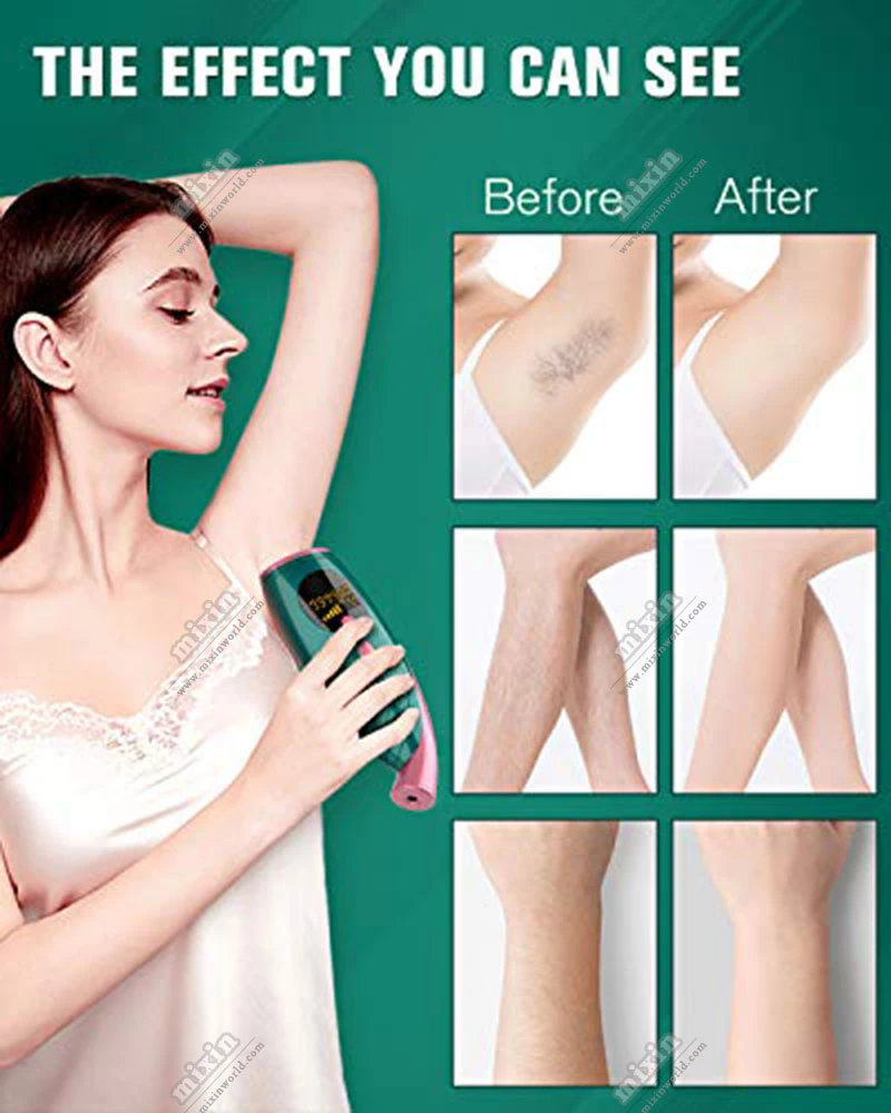 Grs 100% Recycle Profrssional High Power Hair Removal Machine