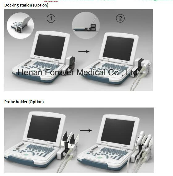 El equipo de diagnóstico portátil Digital de B/W en el Hospital de ultrasonidos