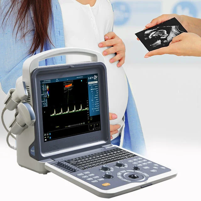 Ultrasound Machine Doppler Color 3D Original Factory