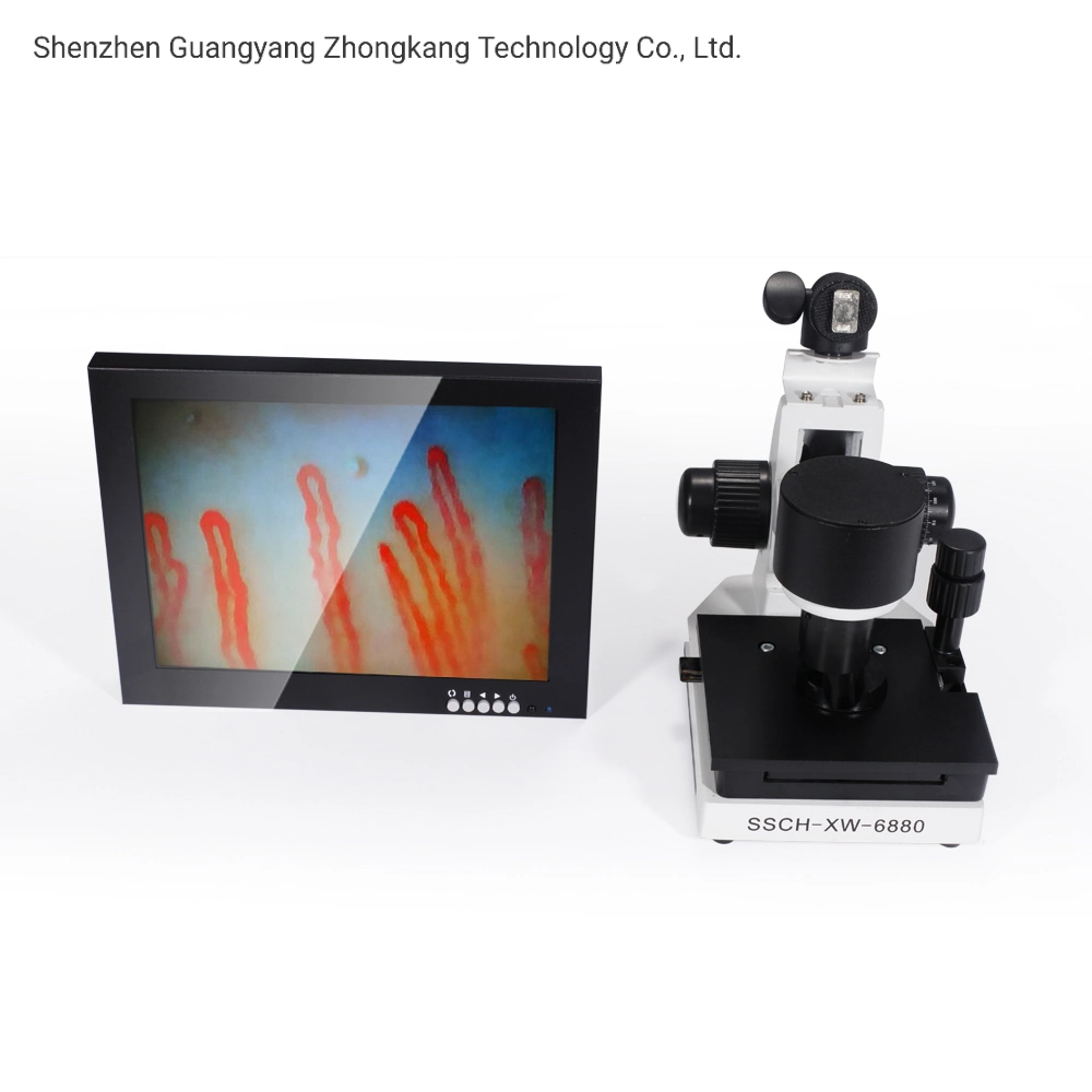 Portable 10 Inch Noninvasive Blood Capillary Microcirculation Microscope