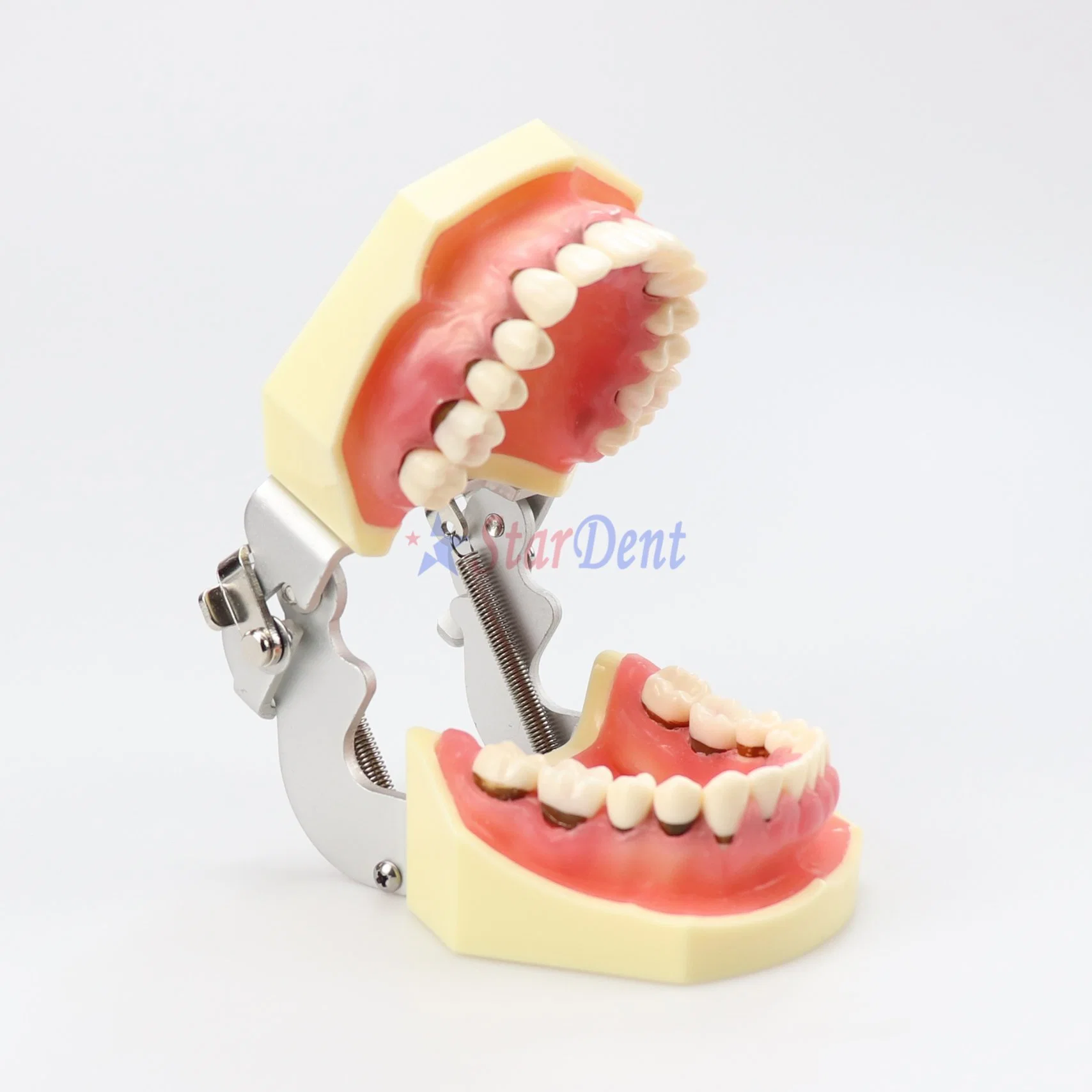 Хорошее качество стоматологических зубодесневых модели преподавания модель демонстрирует серьезно воспалению Gingivae