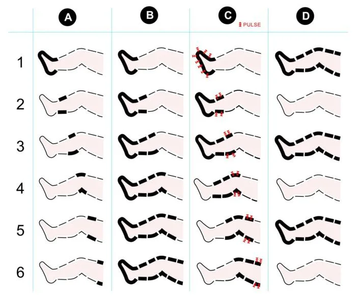 Le massage à compression d'air d'instrument médical est un traitement d'amincissement