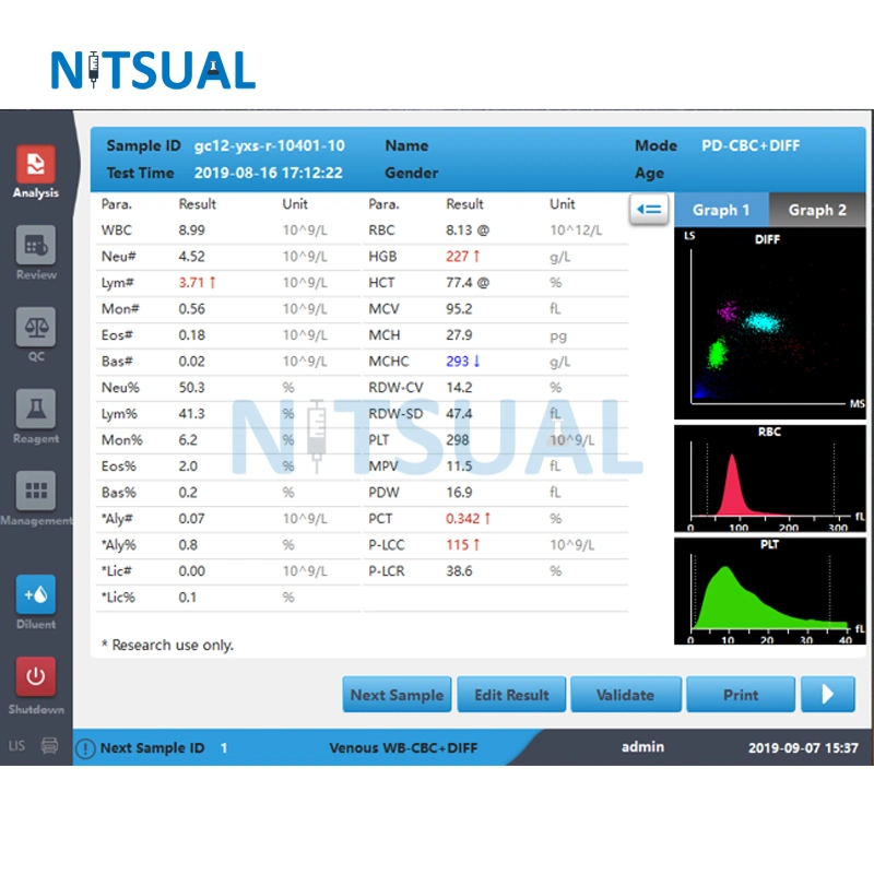 Zybio Clinic analyseur d'hématologie entièrement automatique Chine 5 partie de sang Compteur de cellules pour l'hôpital