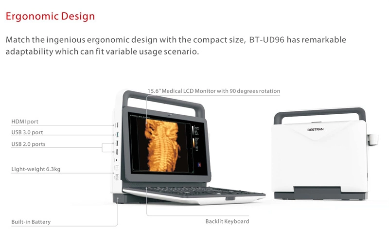 3D 4D Ultra Sonido sistema Doppler Color Hospital de la máquina de ultrasonido escáner dispositivo médico