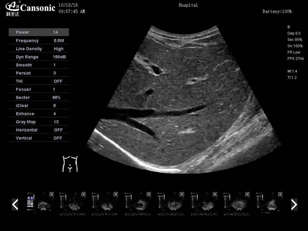 4D Color Doppler Sonograph K10