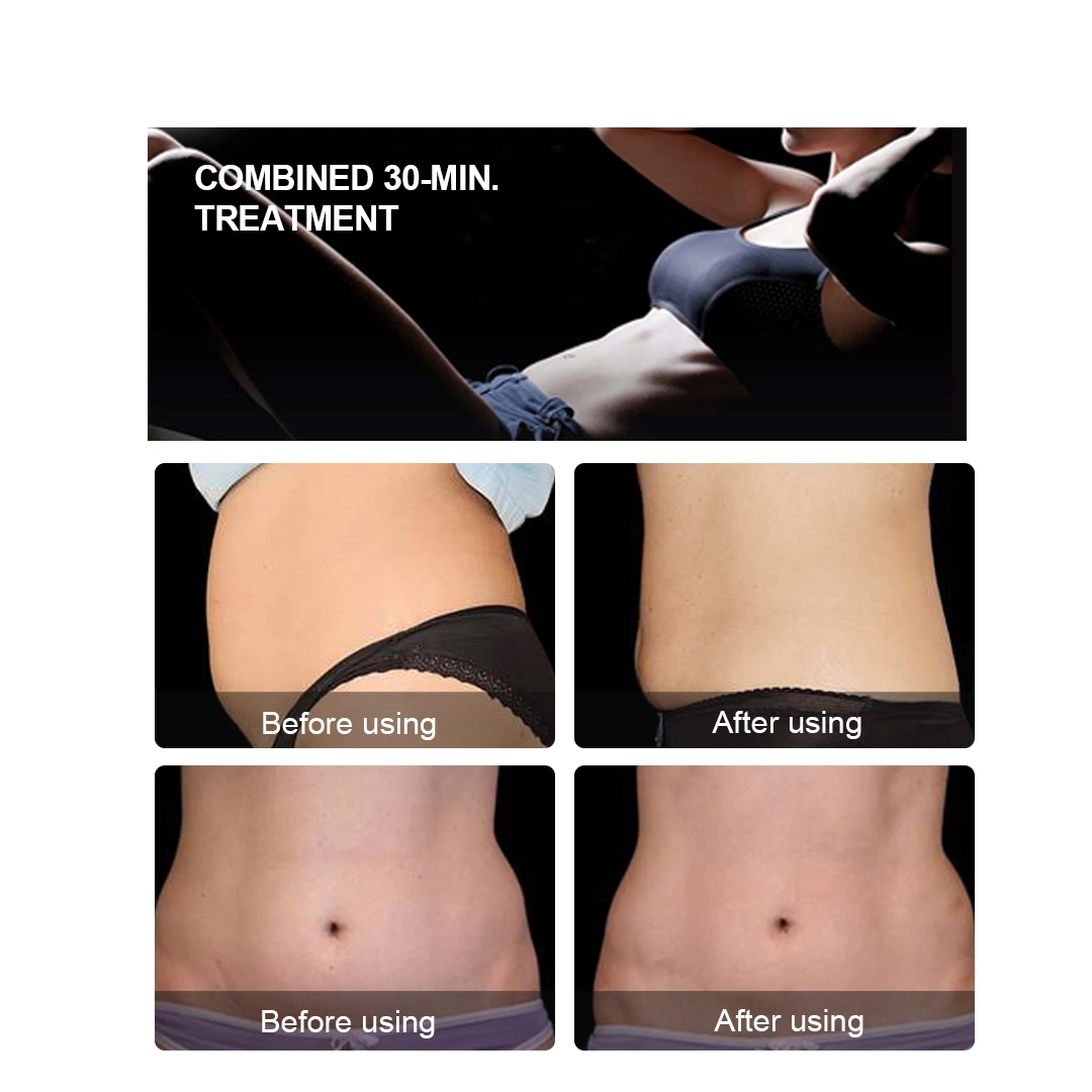 Profesional de alta intensidad con enfoque electromagnético EmSlim 4 maneja EMS Neo Sculpt RF Slimming Machine