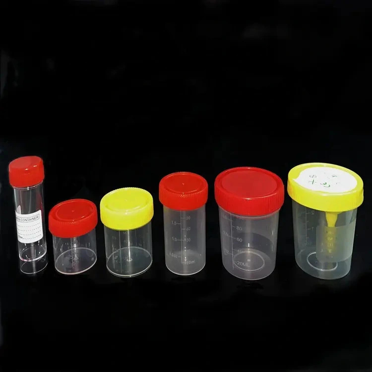 Patient Test Sample Cup Sputum Fecal Specimen Collector 30ml 60ml 120ml Stool Urine Container