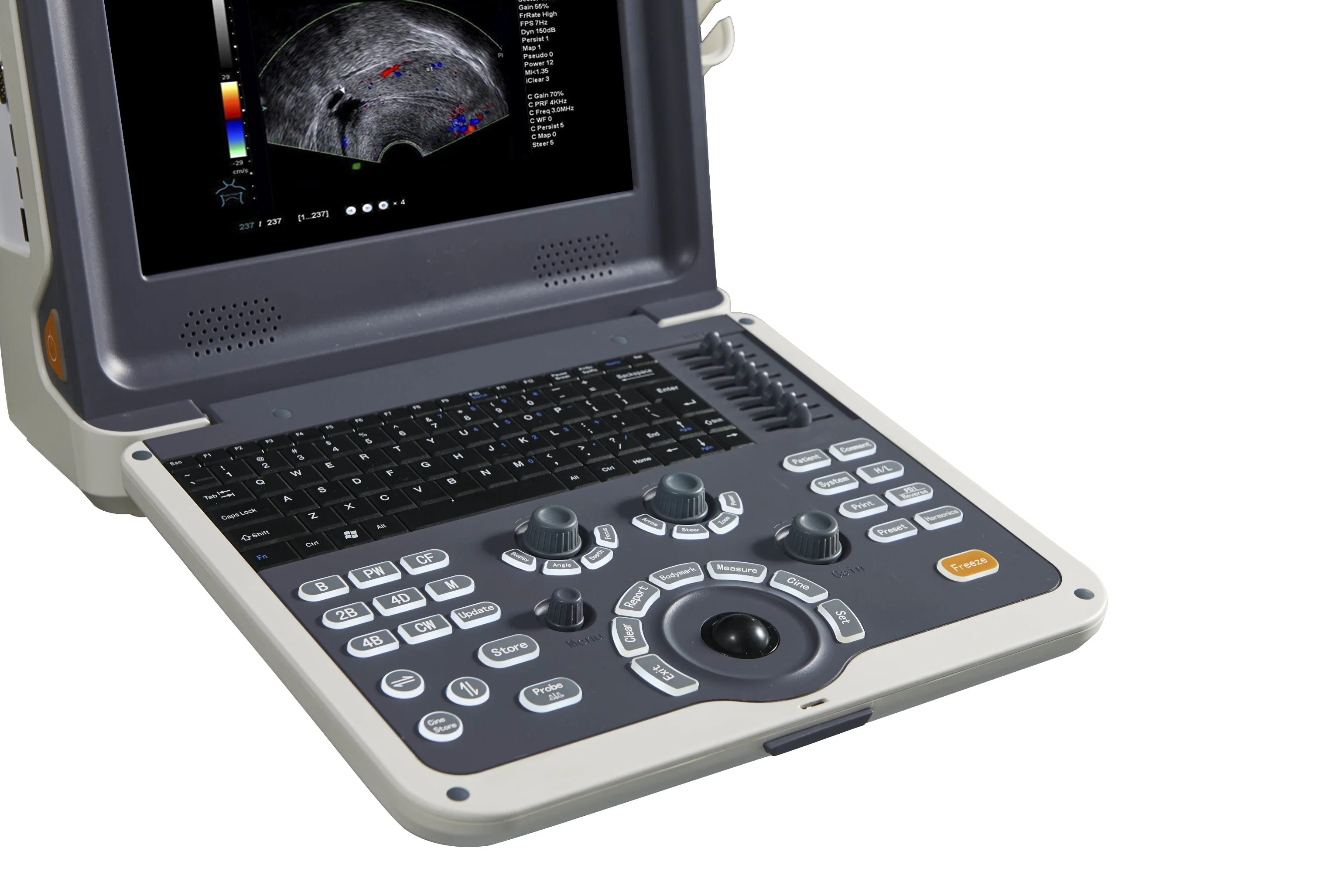 Portable Color Doppler Ultrasound Scanner for Cardiology