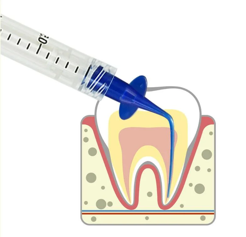 Compuesto de una jeringa de implantes dentales CVS para Lab