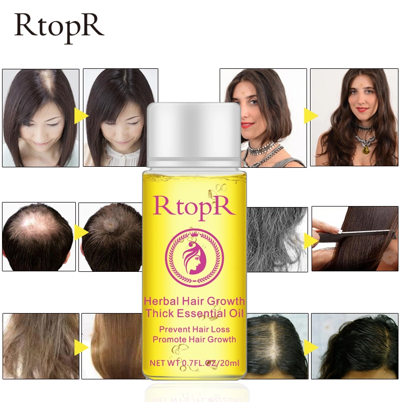 Rtopr Hair Care Natural Organic Hair Loss Treatment Herbal Wild Hair Growth Essential Oil for Women Men