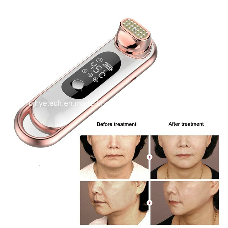 Tragbare RF Instrument Hautverjüngung Schönheit Gesichtsstraffung Hautpflege Behandlung