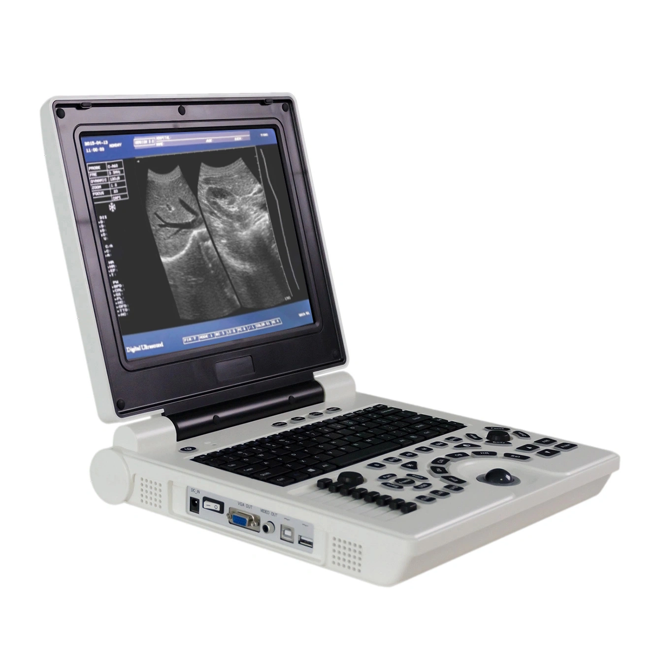 High quality/High cost performance  12 Inch LCD Display B/W Ultrasound Scanner