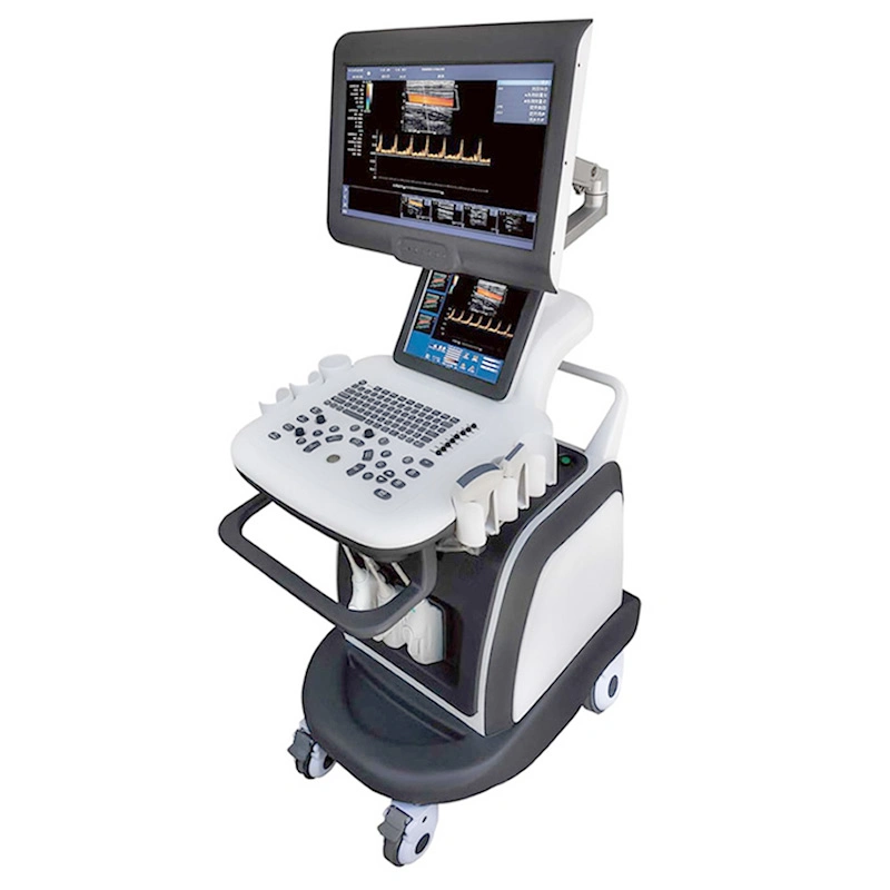 Ultra-Low Price High-End Dual-Screen Dual-System Color Ultrasound