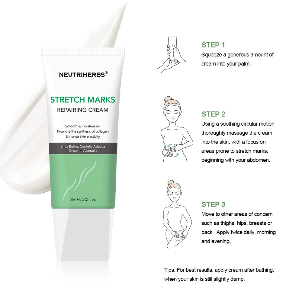 Private Label Remove Stretch Marks Repairing Smooothing Skin Stretch Mark Cream