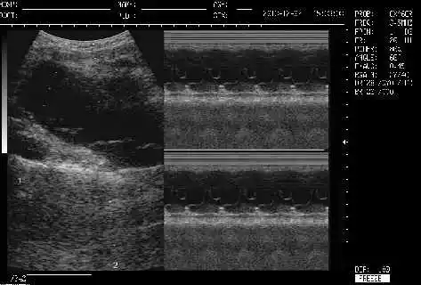 Tragbarer volldigitaler S/W-Ultraschallscanner