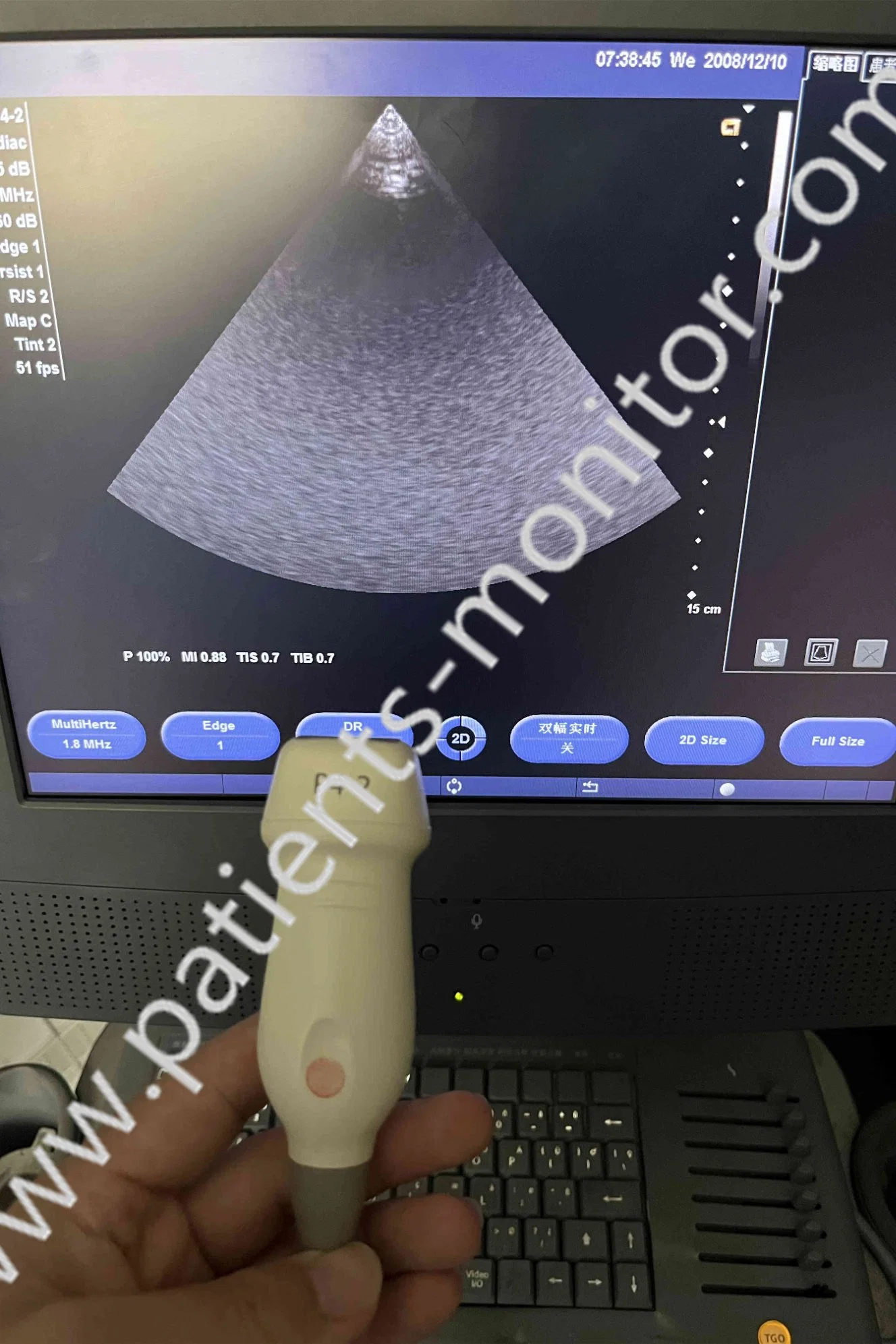 Siemens Acuson X300 Ultrasound P4-2 Transducer Probe Phased Array