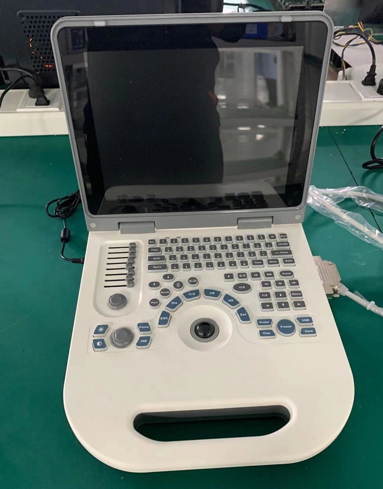 My-A008c Hospital Ultrasonic System Full Digital Laptop Medical Ultrasound Instruments for Diagnosis