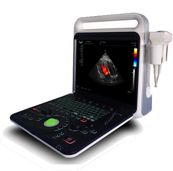 Full Digital Diagnostic Ultrasound Machine Echo Phased Probe Color Doppler Ultrasound Scanner